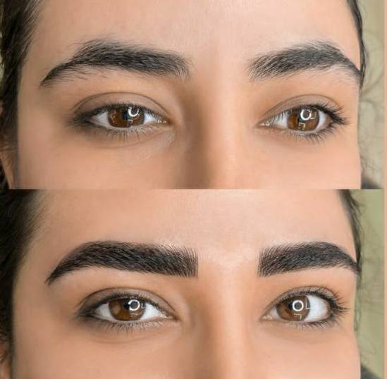 lidahadad میکروبلیدینگ