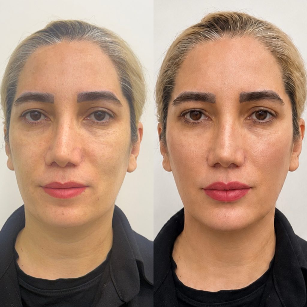 کلینیک تخصصی زاویه‌سازی و کانتورینگ صورت تاج کرج