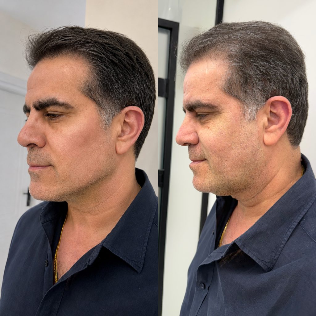 کلینیک زاویه‌سازی و کانتورینگ تاج