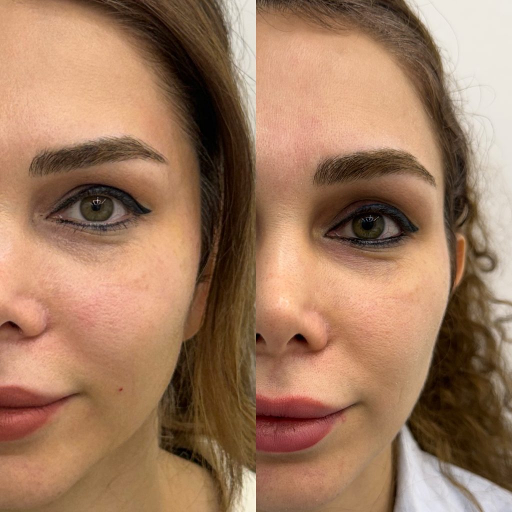 کلینیک زاویه‌سازی و کانتورینگ صورت تاج