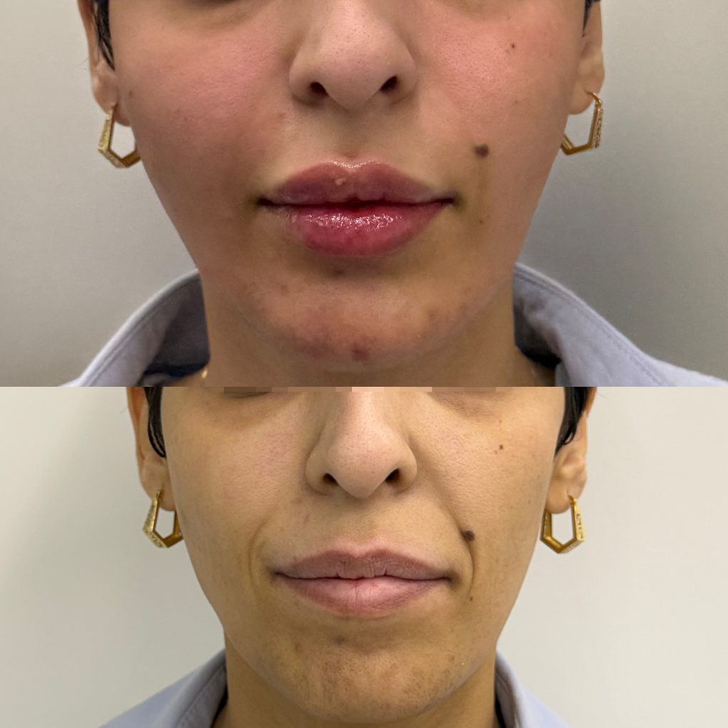 کلینیک تخصصی زاویه‌سازی و کانتورینگ صورت تاج کرج