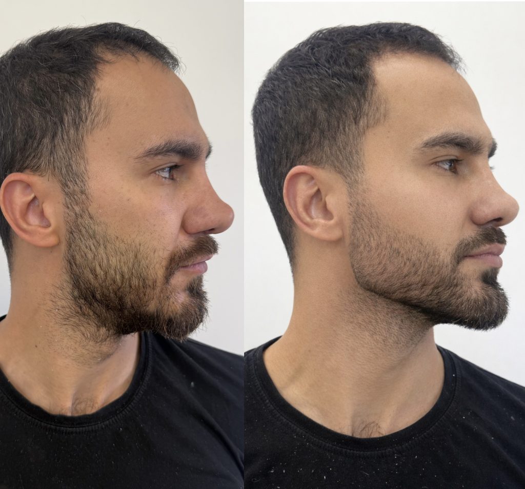 کلینیک تخصصی زاویه‌سازی و کانتورینگ تاج