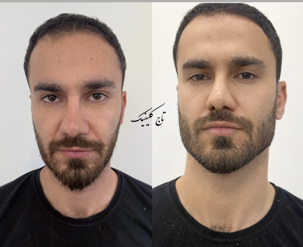 کلینیک تخصصی زاویه‌سازی و کانتورینگ صورت تاج