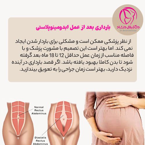 امکان بارداری بعد از ابدومینوپلاستی وجود دارد؟