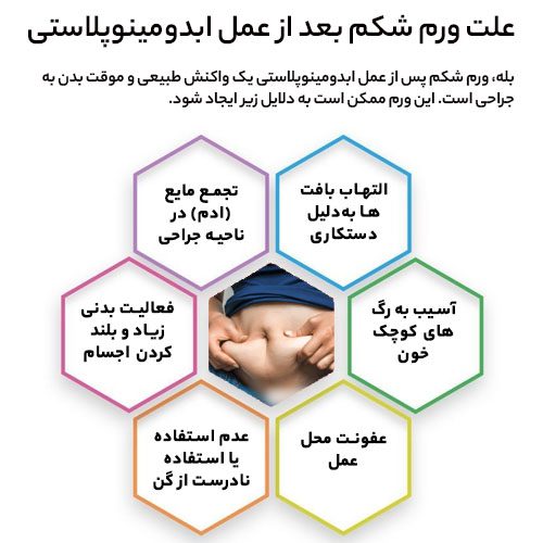 علت ورم شکم بعد از ابدومینوپلاستی