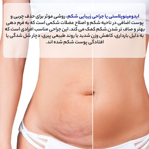 جراح ابدومینوپلاستی در کرج