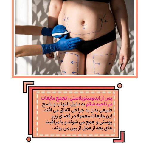 خطرات عمل ابدومینوپلاستی