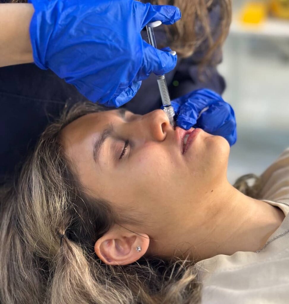 فیلر لب کلینیک آیشیل