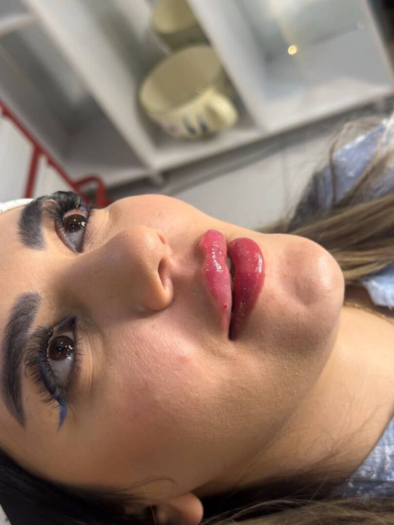 بهترین مرکز لیزر در کرج