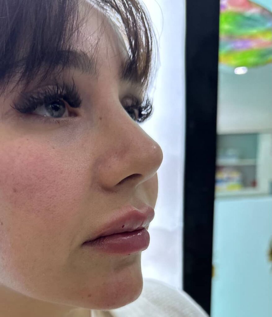 بهترین مرکز لیزر در کرج