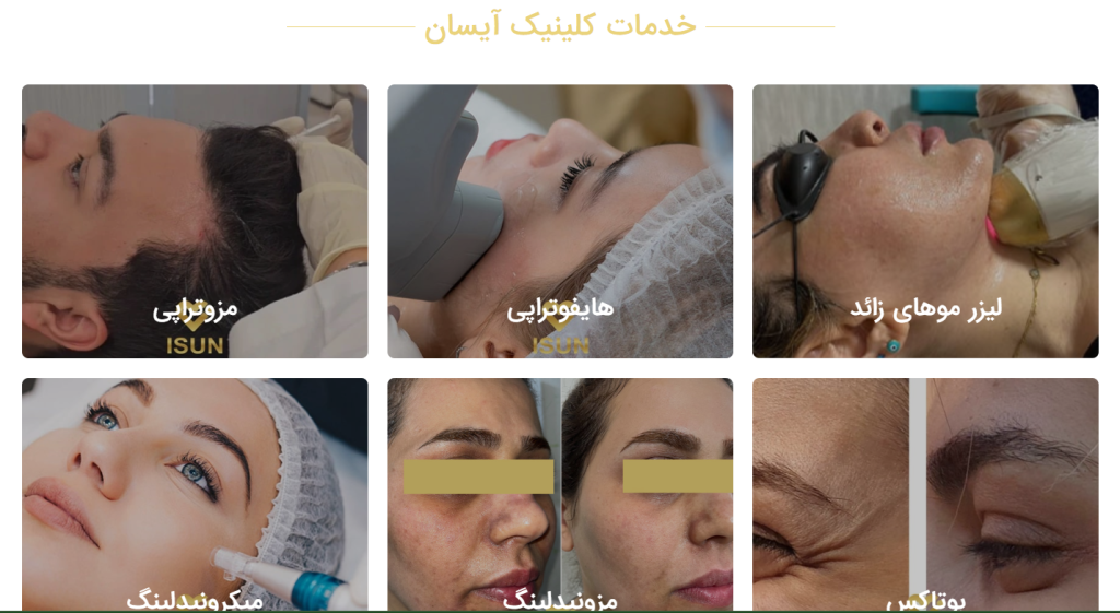کلینیک لیزر موهای زائد آیسان در کرج