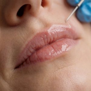 بهترین مراکز تزریق ژل کرج